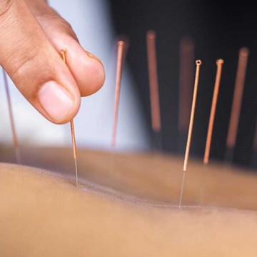 Image for 1 Hour Acupuncture